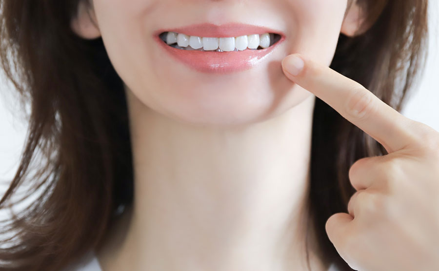 審美歯科について