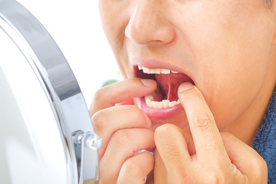 歯周病について